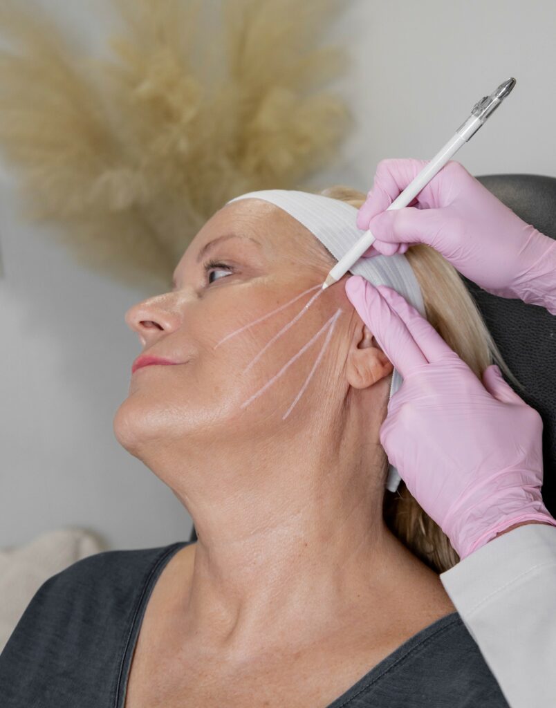 Mid-Aged Women Receive Threads Treatment at Soul Aesthetics in Tulsa, OK