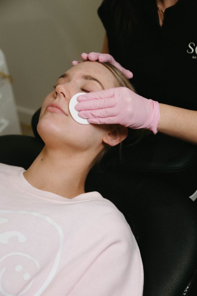 woman receiving a chemical peel treatment