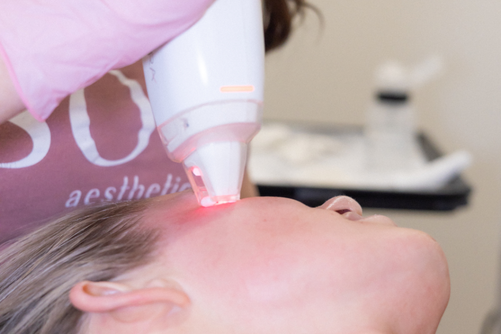 woman using laser therapy on woman's face