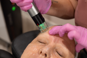 totalskin soulution for comprehensive skin tightening