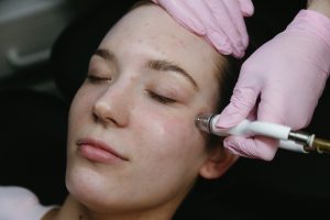 woman receiving a diamond glow facial for stress on face