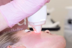 woman receiving laser treatment at Soul