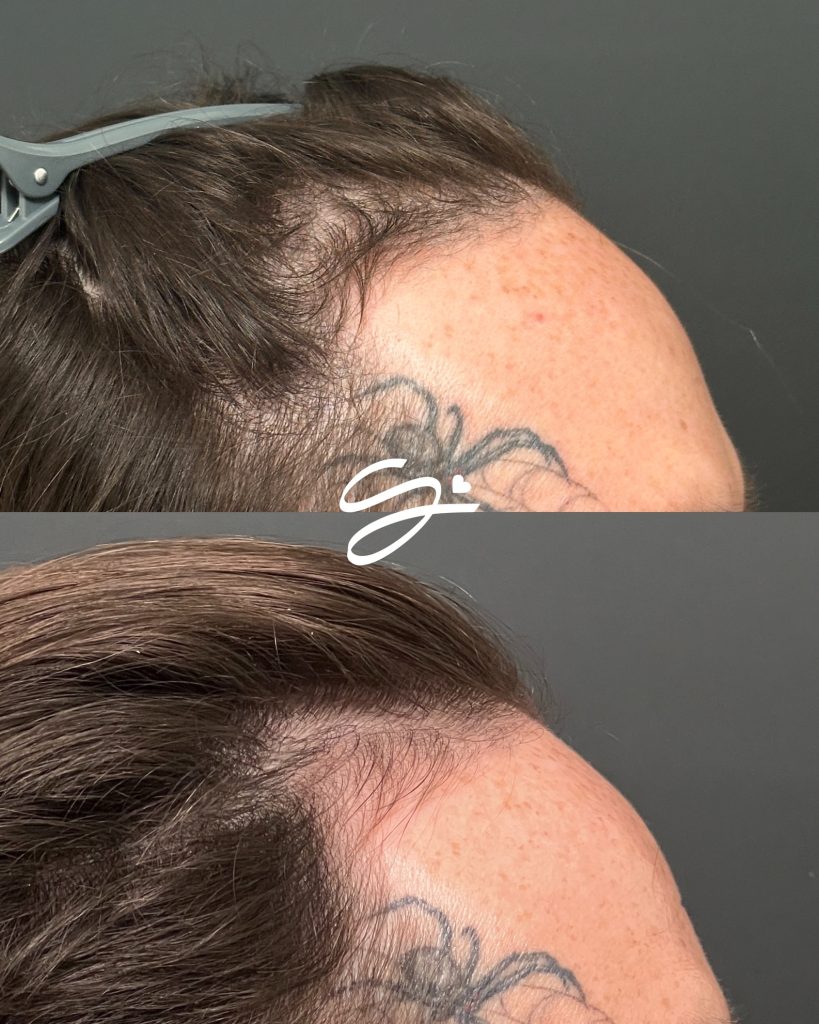 Before & Afters (Portrait) - JW_2