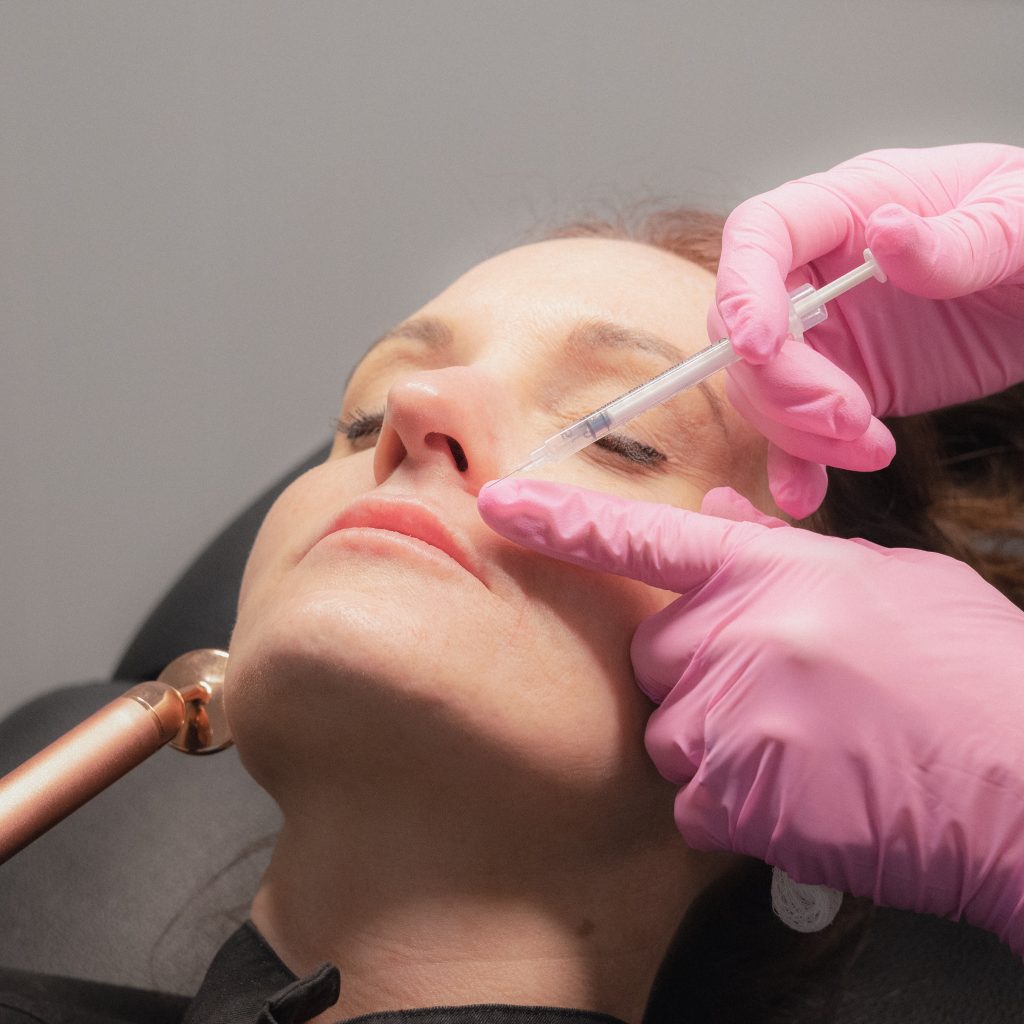 Can Botox Help With a Gummy Smile? What You Need to Know lip filler for a gummy smile