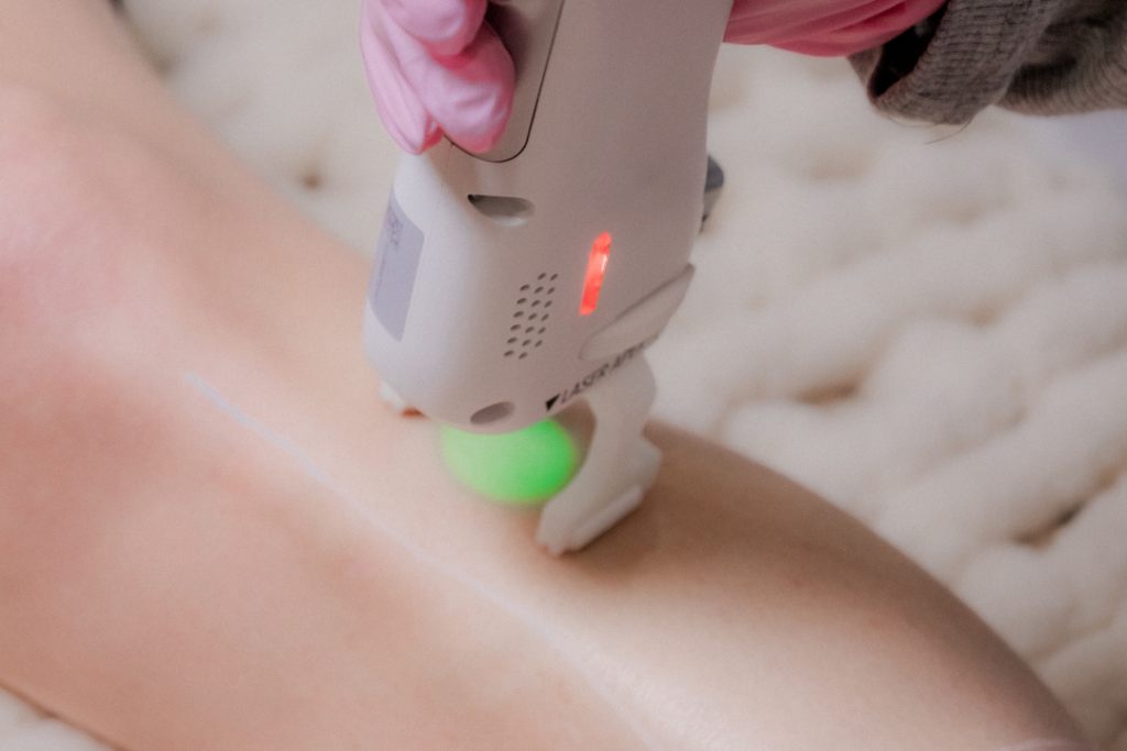 Ditch the Razor. Go Laser: Your Guide to Laser Hair Removal Laser hair removal being performed painlessly on client at soul aesthetics