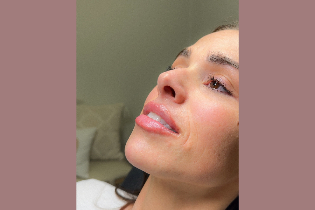 loss of skin elasticity treatment