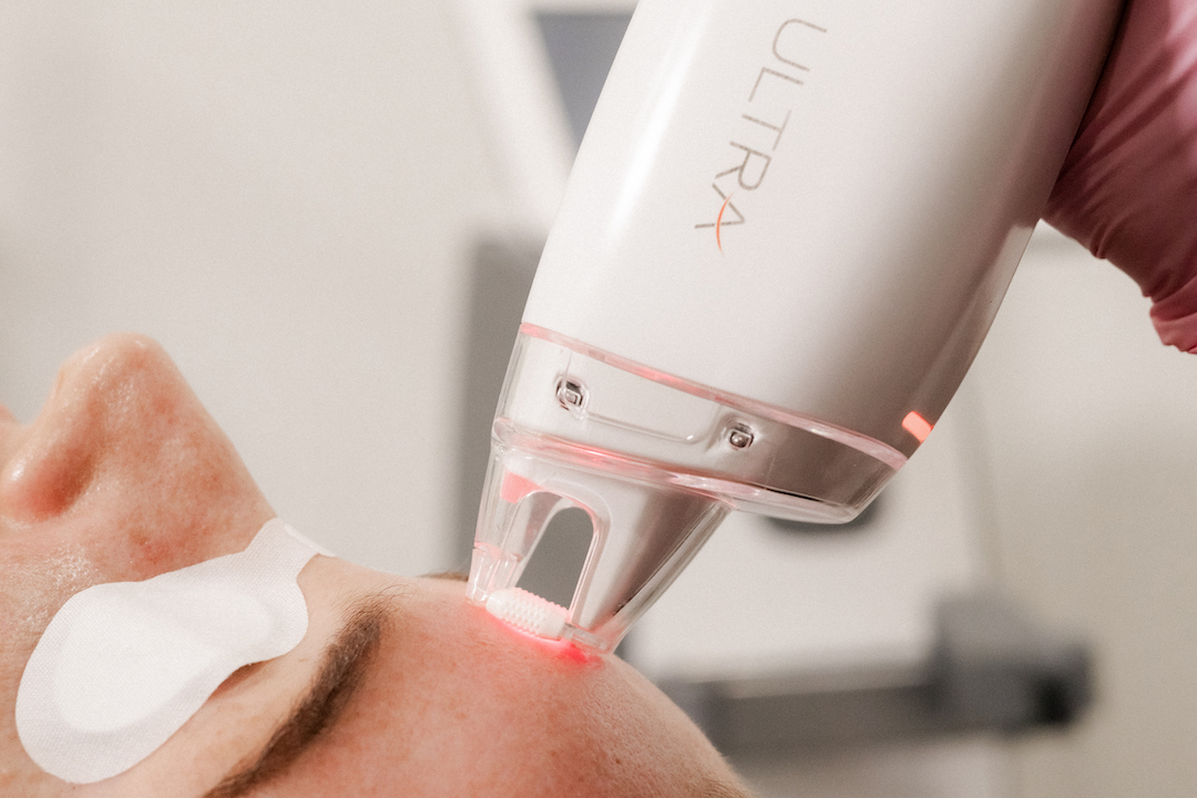 preventative aesthetics treatments