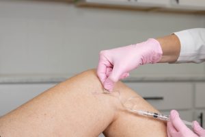 A provider performing sclerotherapy injections on a patient's leg to treat small surface spider veins